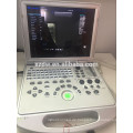 Klinik-grundlegender kardialer Doppler-Ultraschall u. LED-Monitor beweglicher Farbdoppler